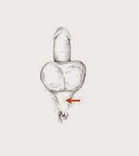 Ko nga uaua o te mana me o raatau uaua ki te whakapiki ake i te mana